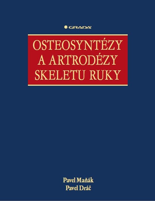 Osteosyntézy a artrodézy skeletu ruky -  Pavel Maňák