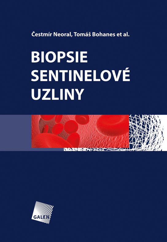 Biopsie sentinelové uzliny -  Tomáš Bohanes