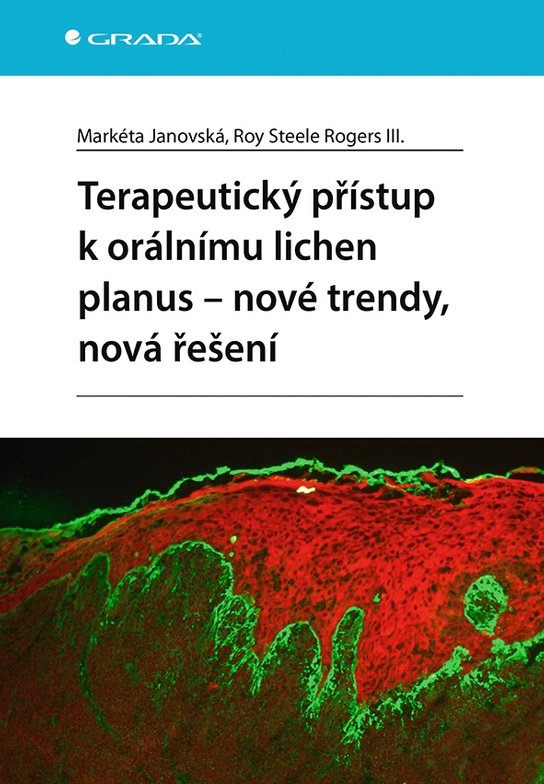 Terapeutický přístup k orálnímu lichen planus - nové trendy, nová řešení -  Markéta Janovská