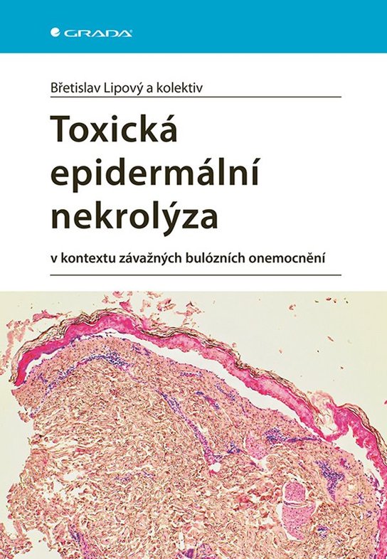 Toxická epidermální nekrolýza -  kolektiv a