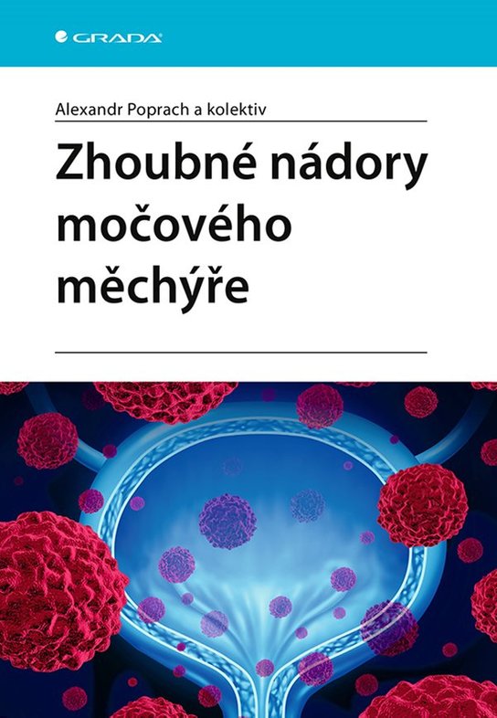 Zhoubné nádory močového měchýře -  Alexandr Poprach