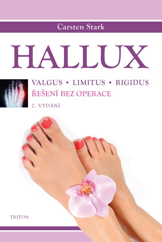 Hallux -  Carsten Stark