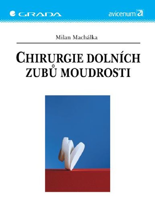 Chirurgie dolních zubů moudrosti -  Milan Machálka