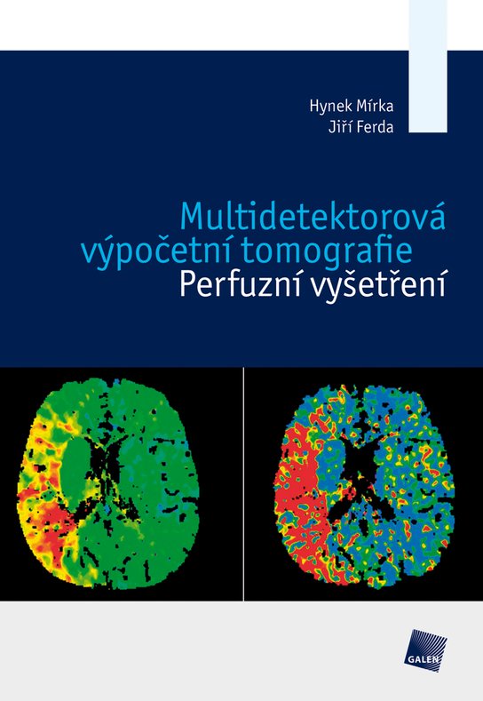 Multidetektorová výpočetní tomografie - Hynek Mírka, Jiří Ferda