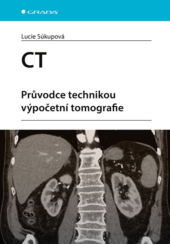 CT - Průvodce technikou výpočetní tomografie -  Lucie Súkupová