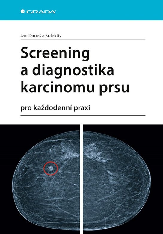 Screening a diagnostika karcinomu prsu -  Jan Daneš