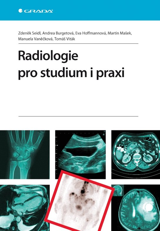 Radiologie pro studium i praxi -  Eva Hoffmannová