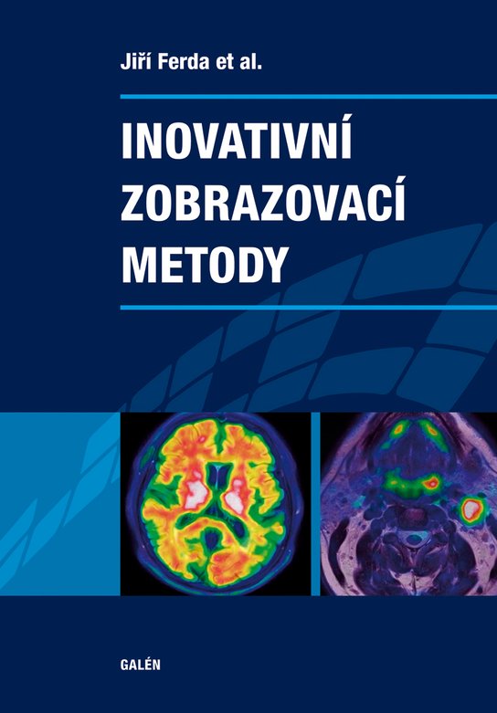 Inovativní zobrazovací metody - Jiří Ferda, kol.