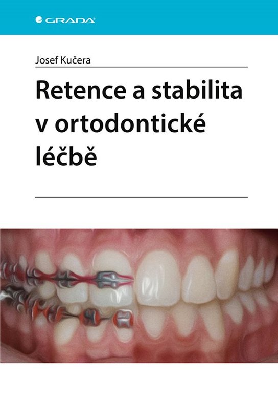 Retence a stabilita v ortodontické léčbě -  Josef Kučera