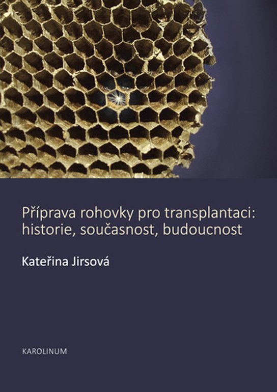 Příprava rohovky pro transplantaci -  Kateřina Jirsová